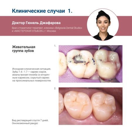 Пломбировочный материал (композит) OptiShade™, 4 г, Kerr