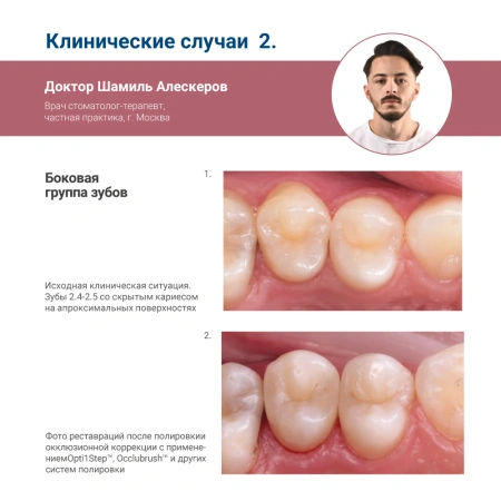 Пломбировочный материал (композит) OptiShade™, 4 г, Kerr